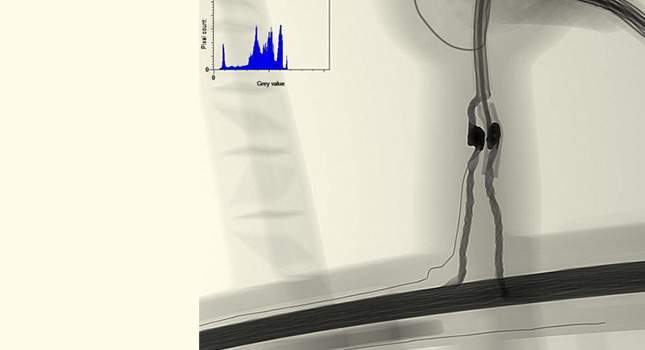 Minelab Equinox Coil X-Ray. Is it really the half of machine?